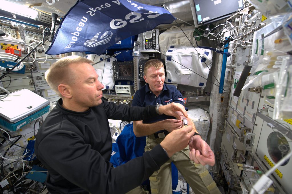 A Study Revealed How Spaceflight Diminishes More Red Blood Cells 27 – space-anemia-2