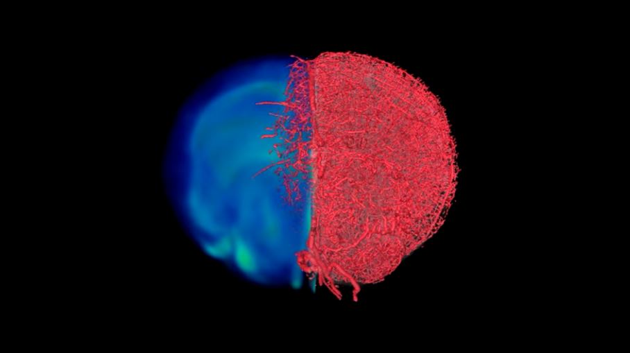 This New 3D Imaging Technique Depictures Blood Vessels 27 – blood-vessels-1